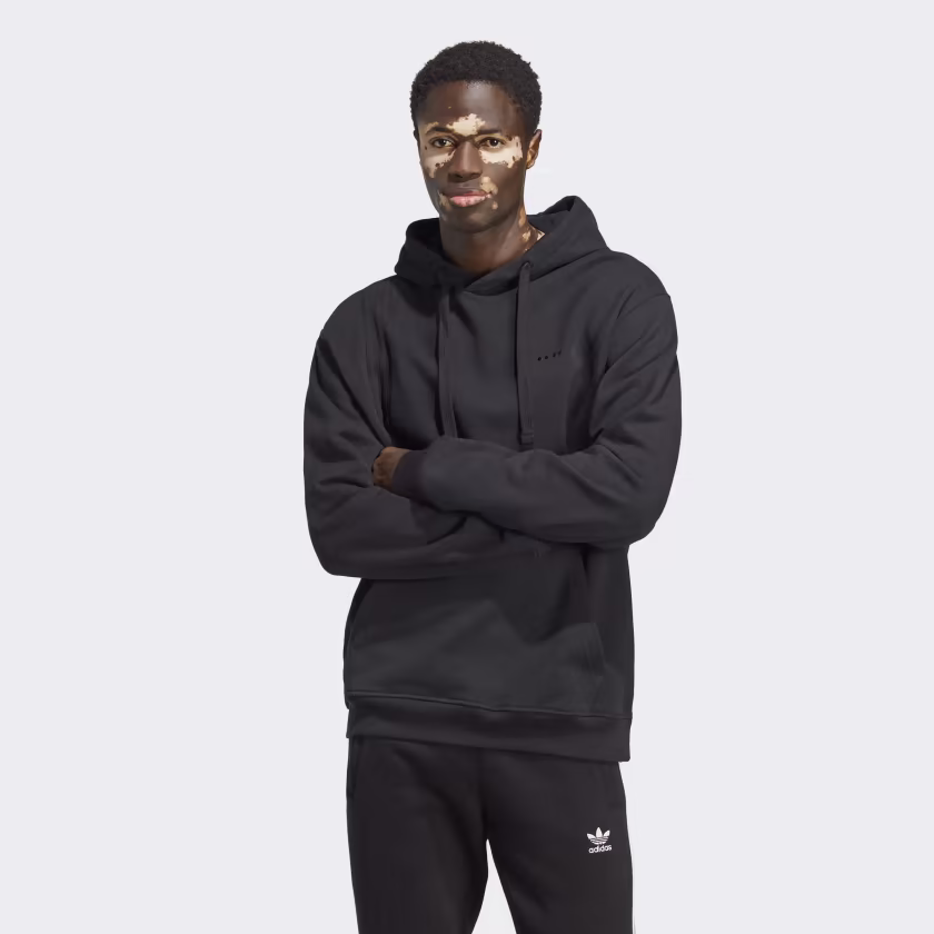 Adidas მამაკაცის ჯემპრი CITY ESS HOODIE